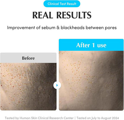 EQQUALBERRY Swimming Pool Toner Pads