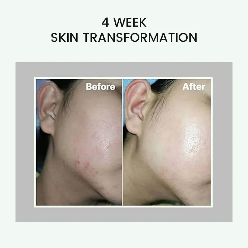 CELIMAX The Real Noni Energy Ampoule - 30ml