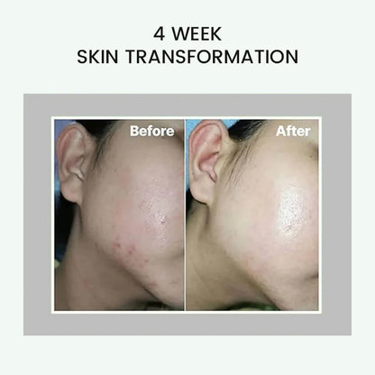 CELIMAX The Real Noni Energy Ampoule - 30ml