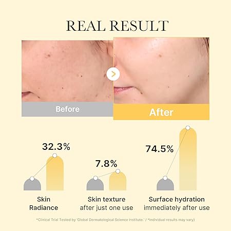 MEDICUBE Masque Gel au curcuma et à l'acide kogique