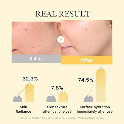 MEDICUBE Masque Gel au curcuma et à l'acide kogique