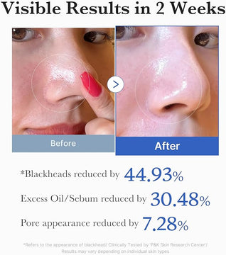 MEDICUBE Zero Pore Pad Exfoliant 2.0