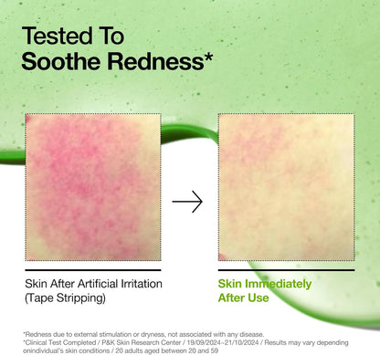 ANUA Azelaic Acid 10 Hyaluron Redness Soothing Serum