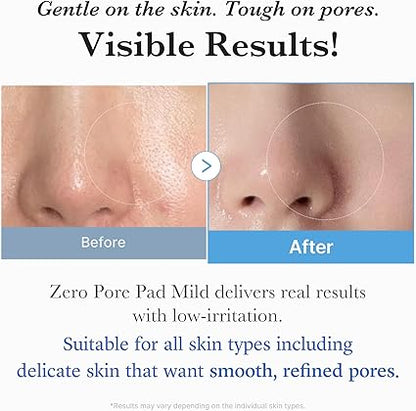 MEDICUBE Zero Pore Pad Mild
