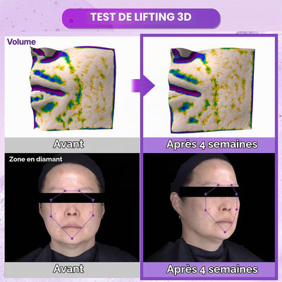 Probioderm 3D Lifting Ampoule