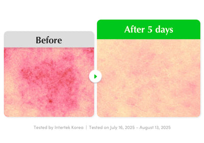 Aloe PDRN Calming Serum