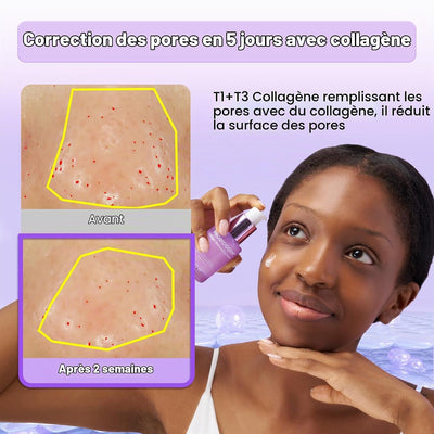 Probioderm Collagen Remodeling Serum