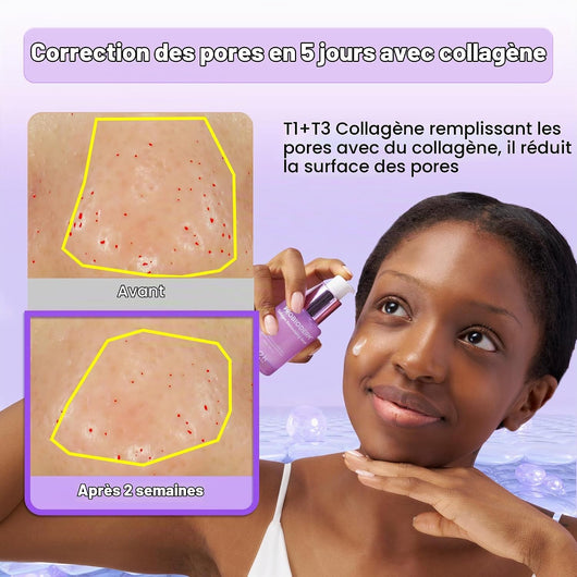 Probioderm Collagen Remodeling Serum