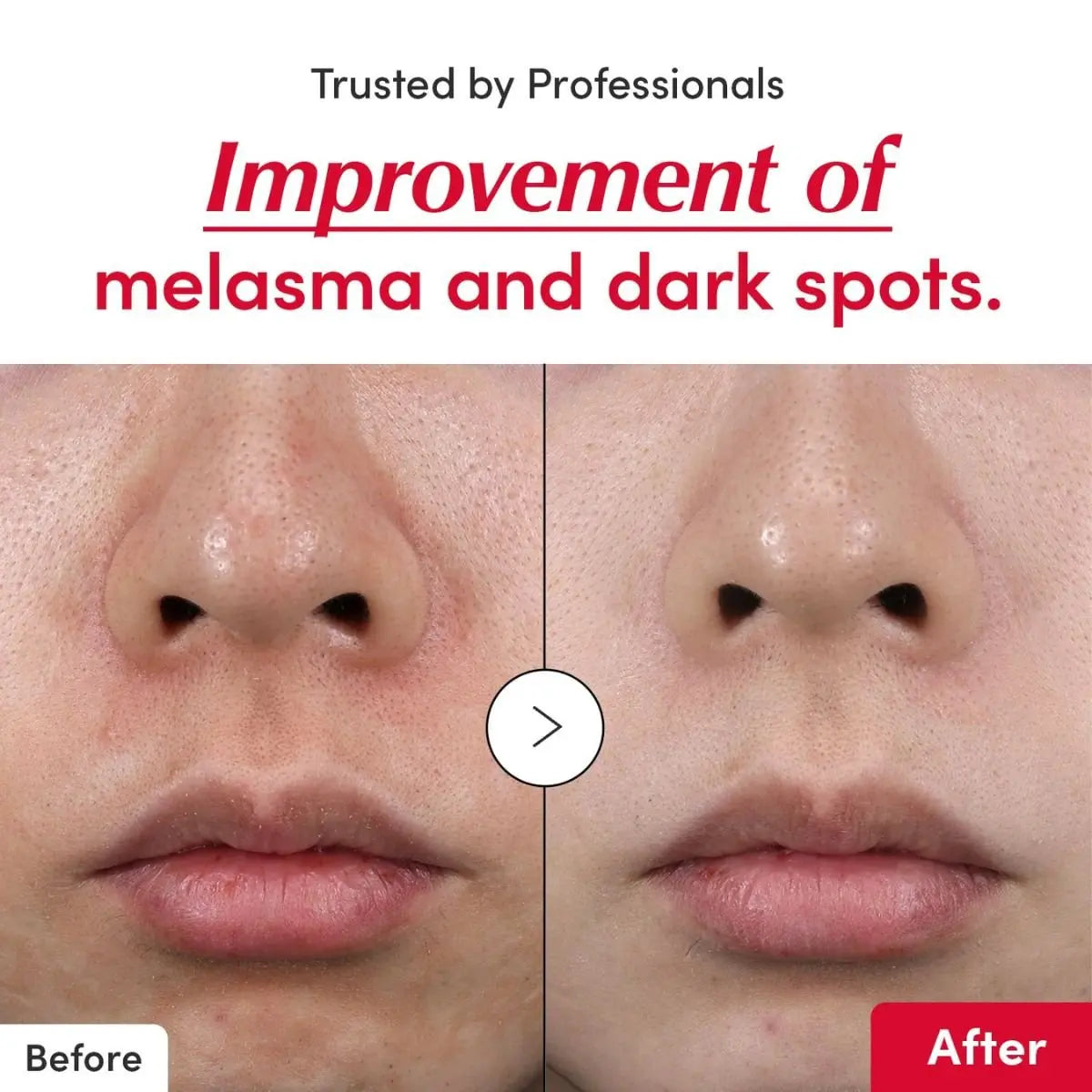 EQQUALBERRY Vitamin Illuminating Serum