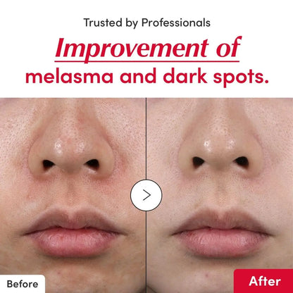 EQQUALBERRY Vitamin Illuminating Serum