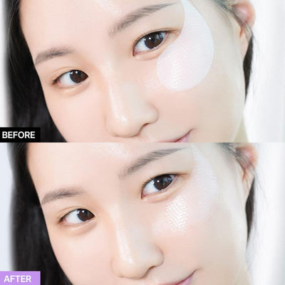 Probioderm Collagen Remodeling Eye Patch