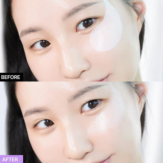 Probioderm Collagen Remodeling Eye Patch